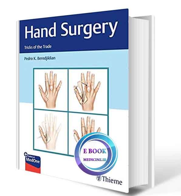 دانلود کتابHand Surgery: Tricks of the Trade 1st 2020 (ORIGINAL PDF)